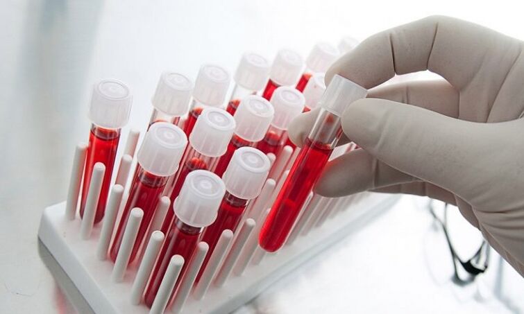 Sangue en tubos de ensaio para análise dun can con prostatite